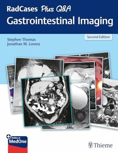 Lorenz, Jonathan M. RadCases Plus Q&A Gastrointestinal Imaging