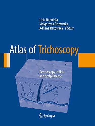 Olszewska, Malgorzata Atlas of Trichoscopy: Dermoscopy in Hair and Scalp Disease