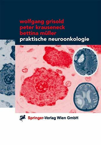 Grisold, Wolfgang Praktische Neuroonkologie (German Edition)