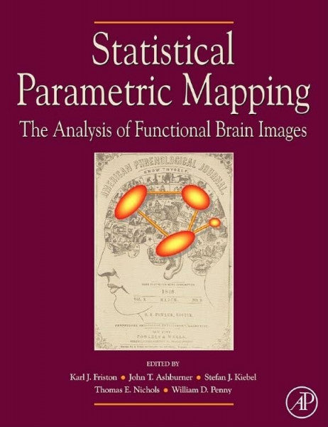 Kiebel, Stefan J. Statistical Parametric Mapping: The Analysis of Functional Brain Images