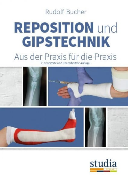 Bucher, Rudolf Reposition und Gipstechnik II: Aus der Praxis für die Praxis