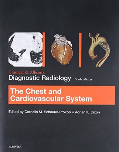 Dixon MD FRCP FRCR FRCS, Adrian K. Grainger & Allison’s Diagnostic Radiology: Chest and Cardiovascular System: The Chest and Cardiovascular System