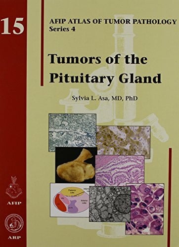 Asa, Sylvia L. Tumors of the Pituitary Gland: AFIP Atlas of Tumor Pathology, Series 4