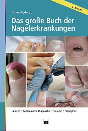Niederau, Anke Das große Buch der Nagelerkrankungen: Ursache, Podologische Diagnostik, Therapie, Prophylaxe