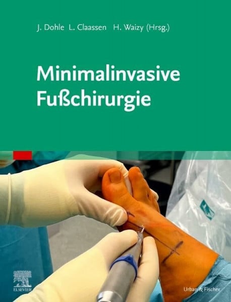 Waizy, Hazibullah Minimalinvasive Fußchirurgie (MONOGRAPHIE - Fachbuch - Urban & Fischer-Verlag)