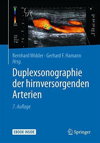 Hamann, Gerhard Duplexsonographie der hirnversorgenden Arterien