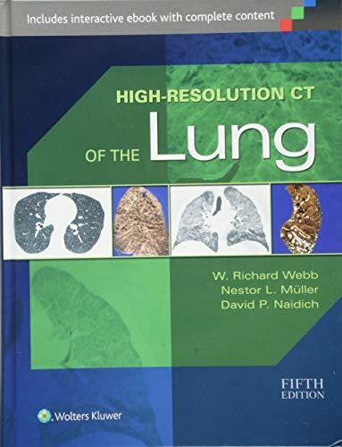 Muller, Nestor L. High-Resolution CT of the Lung