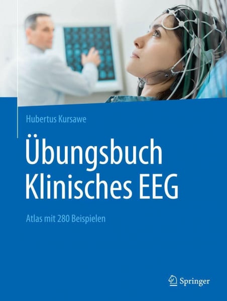 Kursawe, Hubertus Übungsbuch Klinisches EEG: Atlas mit 280 Beispielen