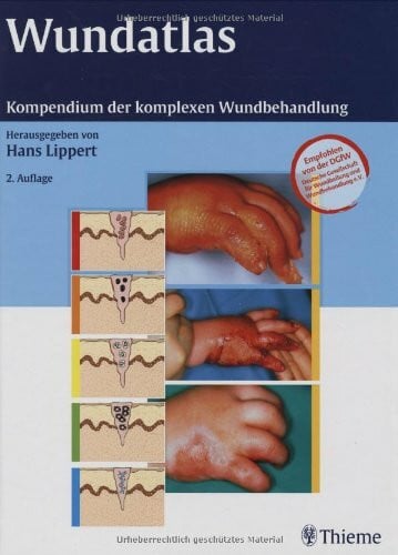 Lippert, Hans Wundatlas: Kompendium der komplexen Wundbehandlung