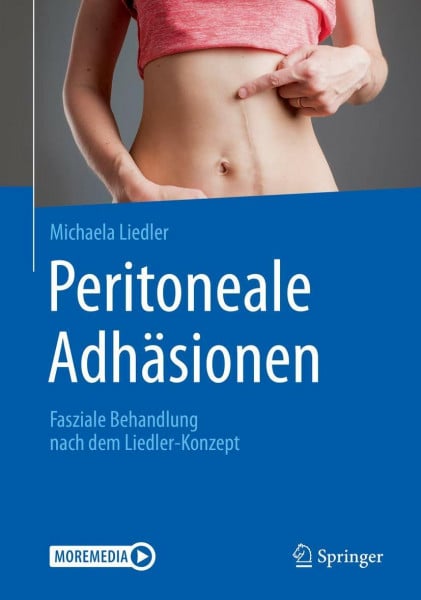 Liedler, Michaela Peritoneale Adhäsionen: Fasziale Behandlung nach dem Liedler-Konzept