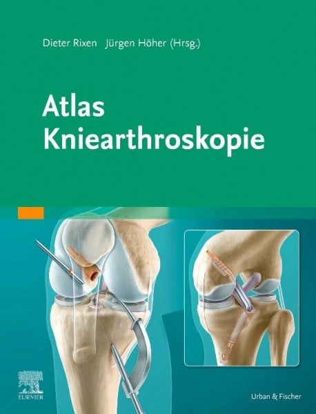 Höher, Jürgen Atlas Kniearthroskopie: Mit Zugang zur Medizinwelt (Arthroskopie-Set Knie/Schulter)