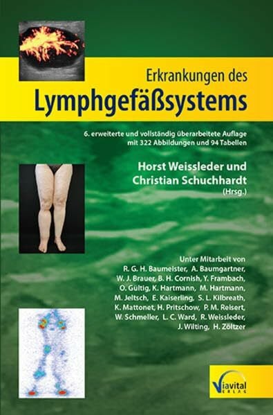 Schuchhardt, Christian Erkrankungen des Lymphgefäßsystems