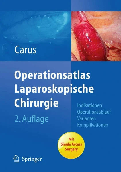 Carus, Thomas Operationsatlas Laparoskopische Chirurgie: Indikationen - Operationsablauf - Varianten - Komplikationen Mit Single Access Surgery