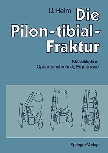 Hefti, F. Die Pilon-tibial-Fraktur: Klassifikation, Operationstechnik, Ergebnisse