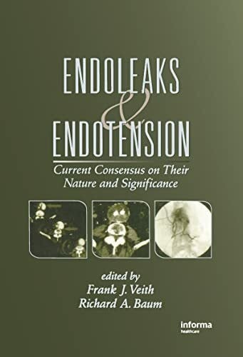 Baum, Richard A. Endoleaks & Endotension: Current Consensus on Their Nature and Significance