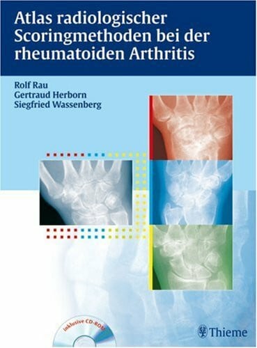 Burmester, Gerd R Atlas der Scoringmethoden bei der rheumatoiden Arthritis: Inkl. CD-ROM mit Buch als pdf