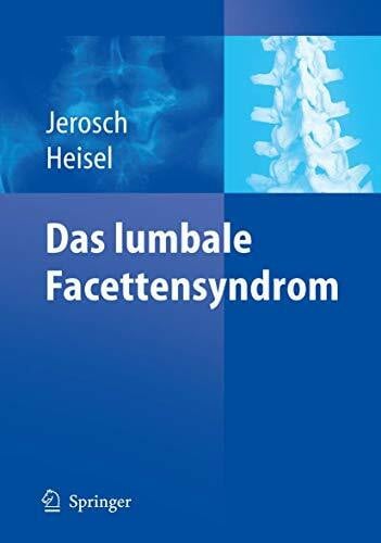 Faustmann, P.M. Das lumbale Facettensyndrom