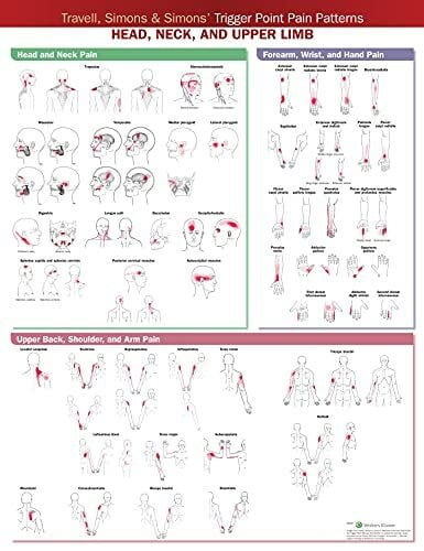 Anatomical Chart Company Travell, Simons & Simons Trigger Point Pain Patterns Wall Chart: Head, Neck, and Upper Limb