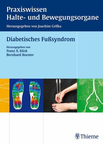Grifka, Joachim Diabetisches FuÃsyndrom (Reihe, Praxisw. Halte-Bew.)