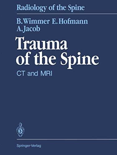 Augustinus L. H. Jacob Trauma of the Spine. CT and MRI