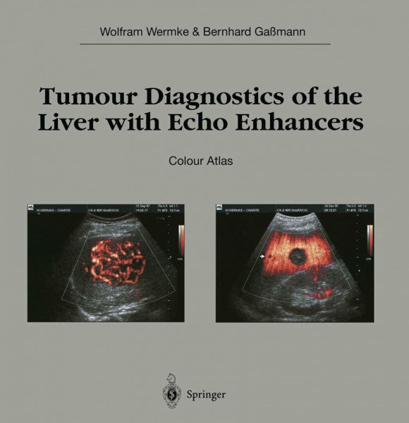 Gaßmann, Bernhard Tumour Diagnostics of the Liver with Echo Enhancers: Colour Atlas