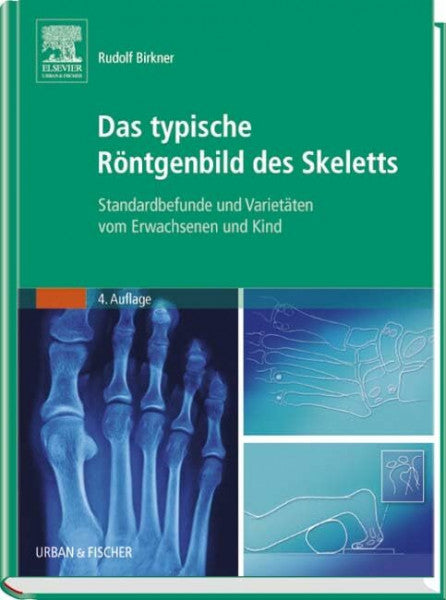 Birkner, Rudolf Das typische RÃ¶ntgenbild des Skeletts: Standardbefunde und VarietÃ¤ten vom Erwachsenen und Kind