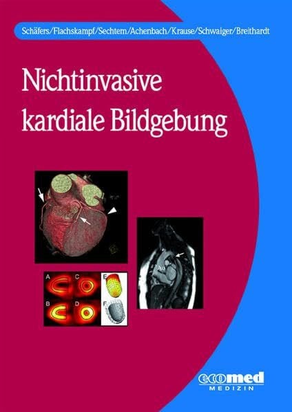 Breithardt, GÃ¼nter Nichtinvasive kardiale Bildgebung: Spektrum, Methodik, Indikation und Interpretation