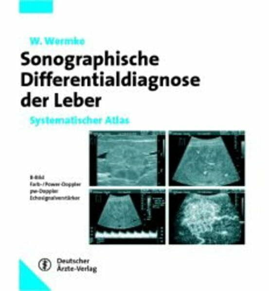 Sonographische Differenzialdiagnose Leberkrankheiten: Systematischer Atlas