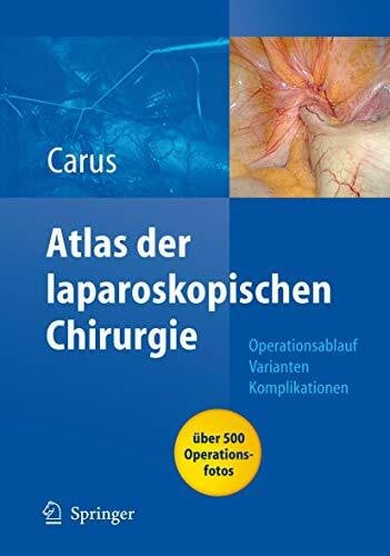 Carus, Thomas Operationsatlas Laparoskopische Chirurgie: Indikationen - Operationsablauf - Varianten - Komplikationen Mit Single Access Surgery