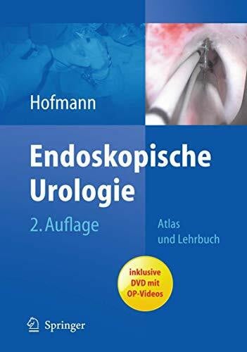 Hofmann, Rainer Endoskopische Urologie: Atlas und Lehrbuch