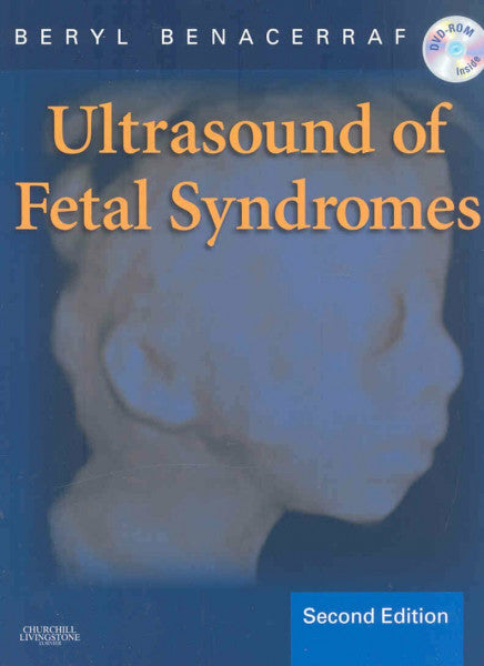Benacerraf, Beryl R. Ultrasound of Fetal Syndromes, w. DVD: Text with DVD