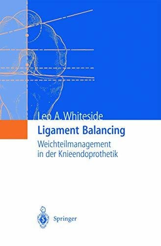 Whiteside, Leo A. Ligament Balancing: Weichteilmanagement in der Knieendoprothetik