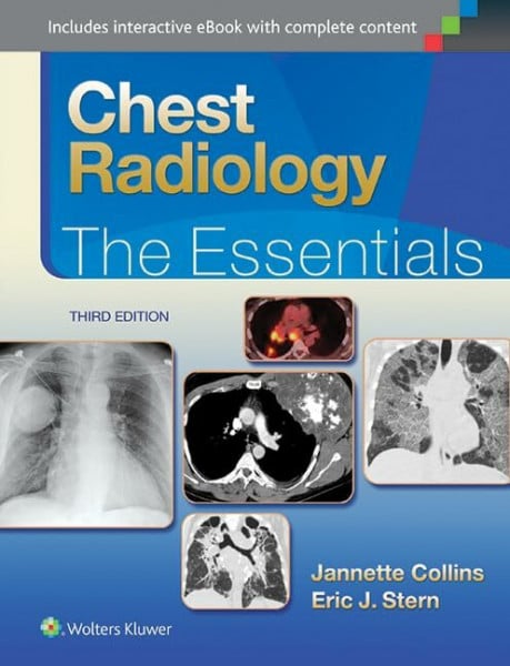 Collins Chest Radiology: The Essentials