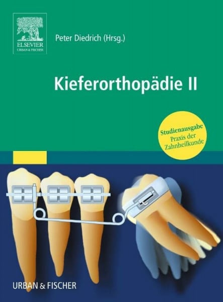 Diedrich, Peter KieferorthopÃ¤die II: Praxis der Zahnheilkunde - Studienausgabe (PDZ)