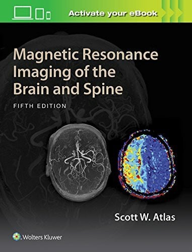 Atlas, Scott W. Magnetic Resonance Imaging of the Brain and Spine, 5 Vols.