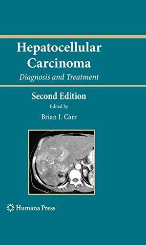 Carr, Brian I. Hepatocellular Carcinoma: Diagnosis and Treatment (Current Clinical Oncology)