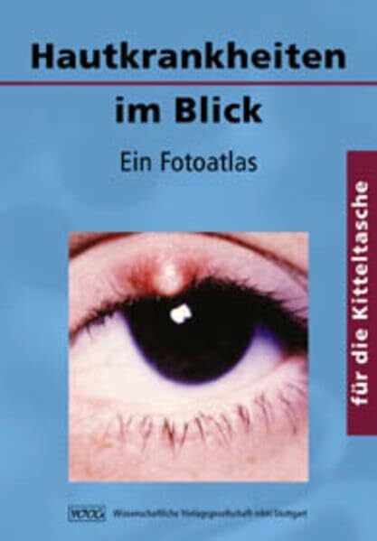 Adler, Yael Hautkrankheiten im Blick: Ein Fotoatlas für die Kitteltasche