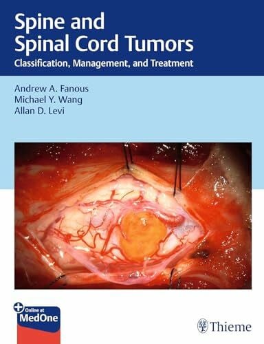 Levi, Allan Spine and Spinal Cord Tumors: Classification, Management, and Treatment