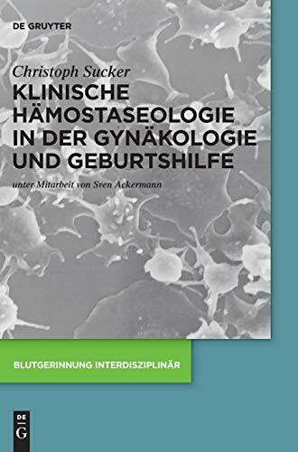 Sucker, Christoph Klinische Hämostaseologie in der Gynäkologie und Geburtshilfe (Blutgerinnung interdisziplinär)