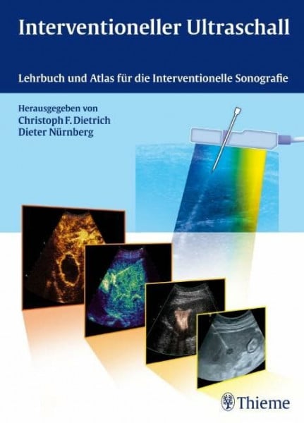 Nürnberg, Dieter Interventioneller Ultraschall: Lehrbuch und Atlas für die Interventionelle Sonografie