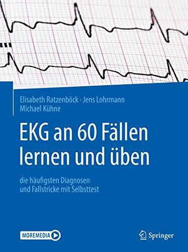 Kühne, Michael EKG an 60 Fällen lernen und üben: die häufigsten Diagnosen und Fallstricke mit Selbsttest