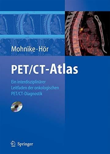 Gustav Hör PET/CT-Atlas: Ein interdisziplinärer Leitfaden der onkologischen PET/CT-Diagnostik