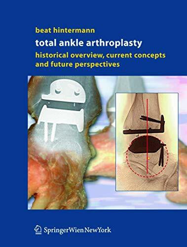 Hintermann, Beat Total Ankle Arthroplasty: Historical Overview, Current Concepts and Future Perspectives