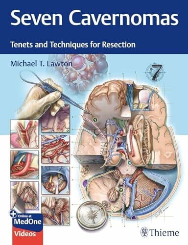 Lawton, Michael T. Seven Cavernomas: Tenets and Techniques for Resection