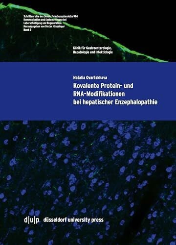 Qvartskhava, Natalia Kovalente Protein- und RNA-Modifikationen bei hepatischer Enzephalopathie (Schriftenreihe des Sonderforschungsbereich 974, 3, Band 3)