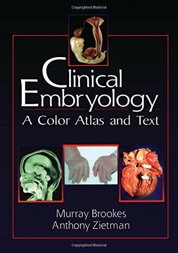 Brookes, Murray Clinical Embryology: A Color Atlas and Text