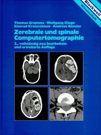Kluge, Wolfgang Zerebrale und spinale Computertomographie