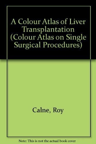 Calne, Roy A Colour Atlas of Liver Transplantation (Colour Atlas on Single Surgical Procedures S., Band 27)