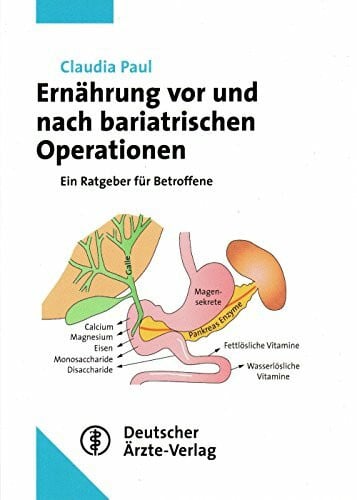 Paul, Claudia Ernährung vor und nach bariatrischen Operationen: Ein Ratgeber für Betroffene