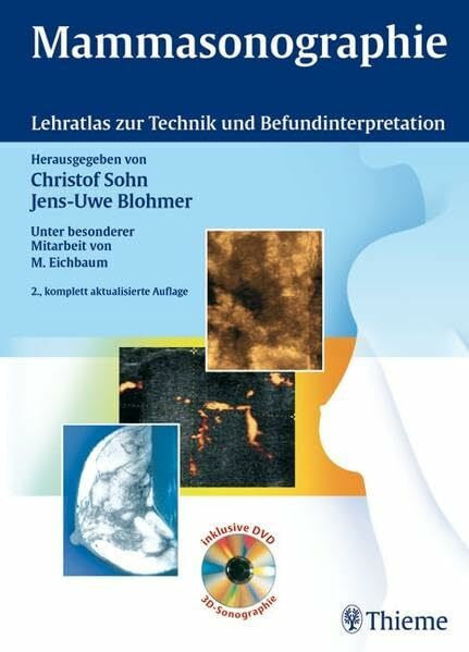 Sinn, Hans-Peter Mammasonographie: Lehratlas zur Technik und Befundinterpretation